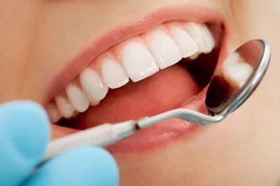 patient's teeth after dental bonding